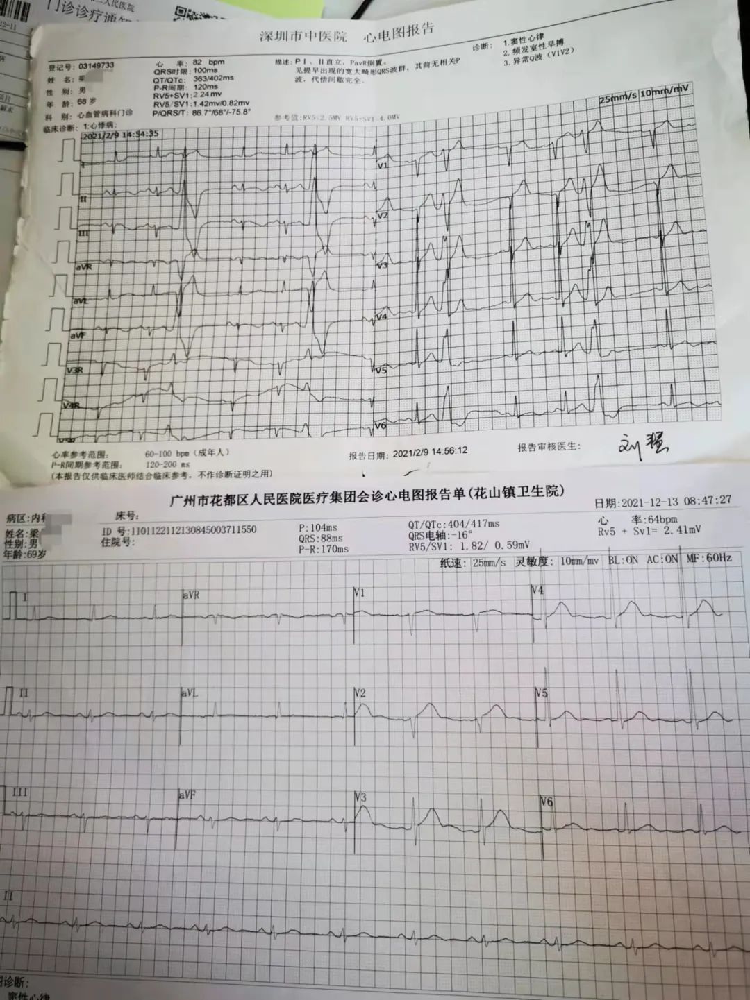 【案例】心脏早搏针灸也能治？79岁阿伯三次针灸后症状消失