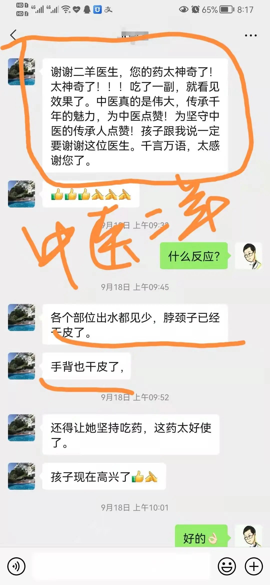 11岁小孩顽固性湿疹,病了11年!二羊有幸帮到她除顽疾 11岁小孩顽固性湿疹,病了11年!二羊有幸帮到她除顽疾